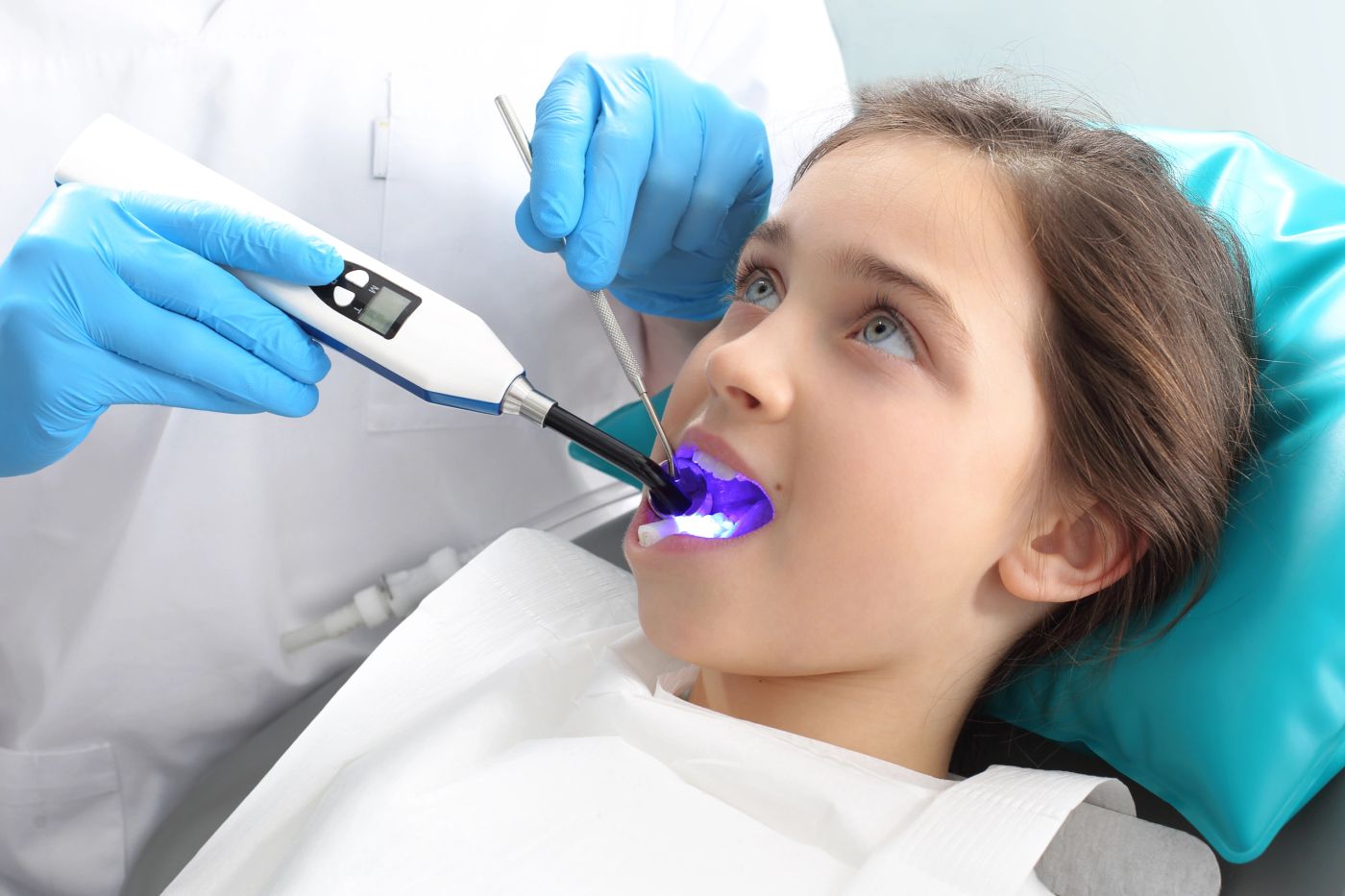 Dental Sealants in Tysons Corner, VA
