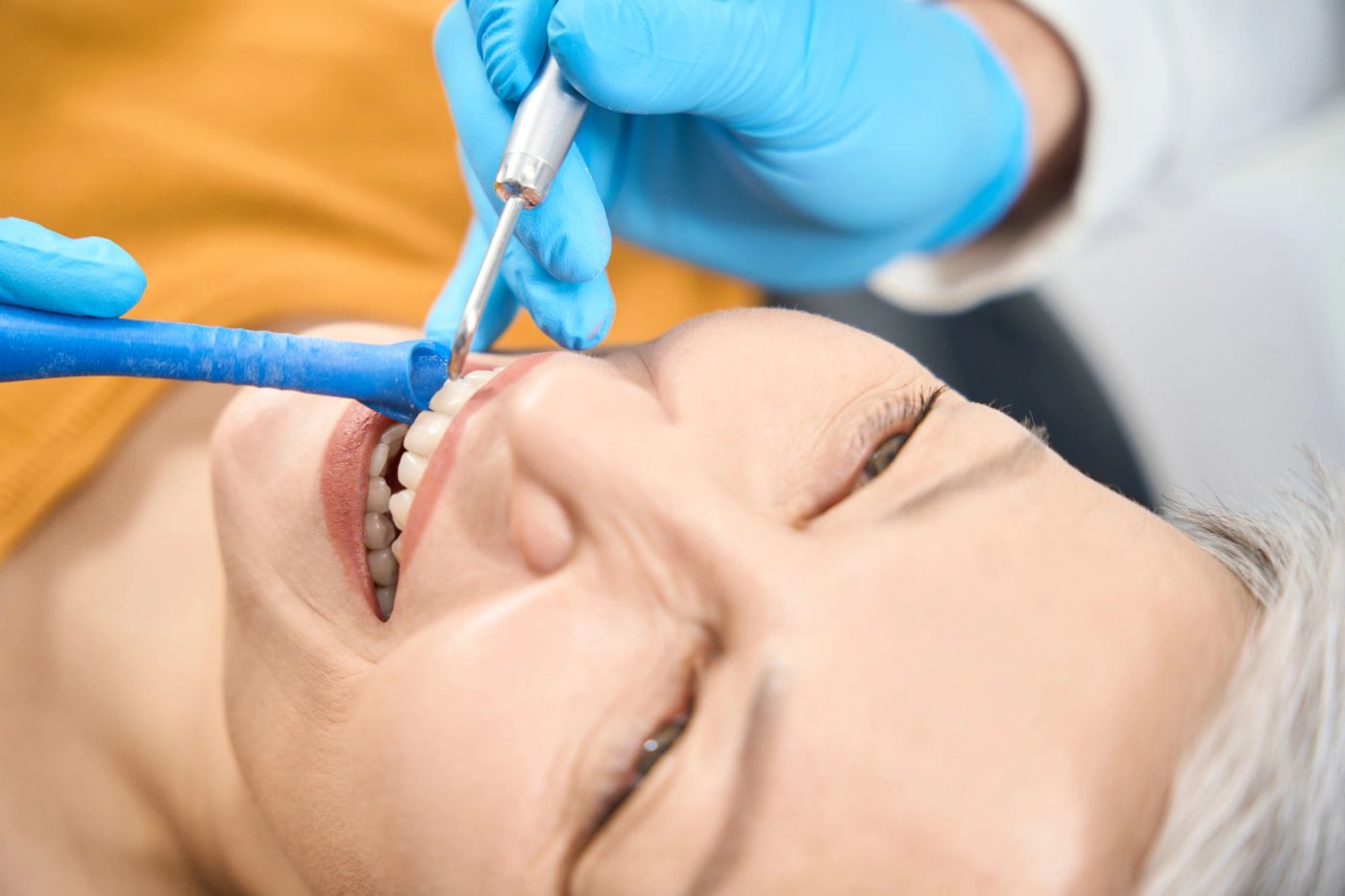 Fluoride Treatment in Tysons Corner, VA