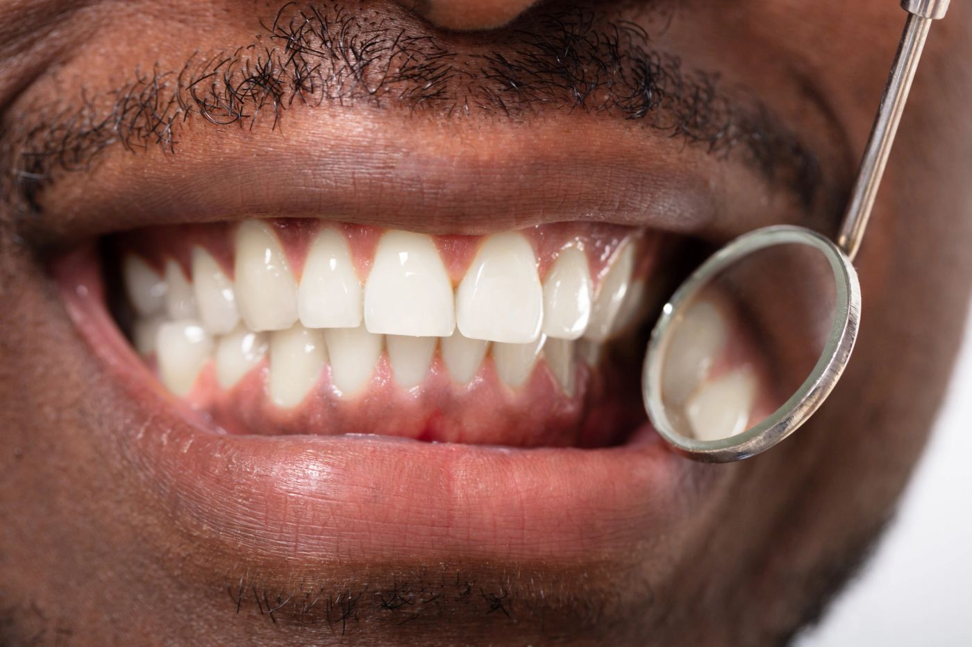 Gum Disease Therapy in Tysons Corner, VA
