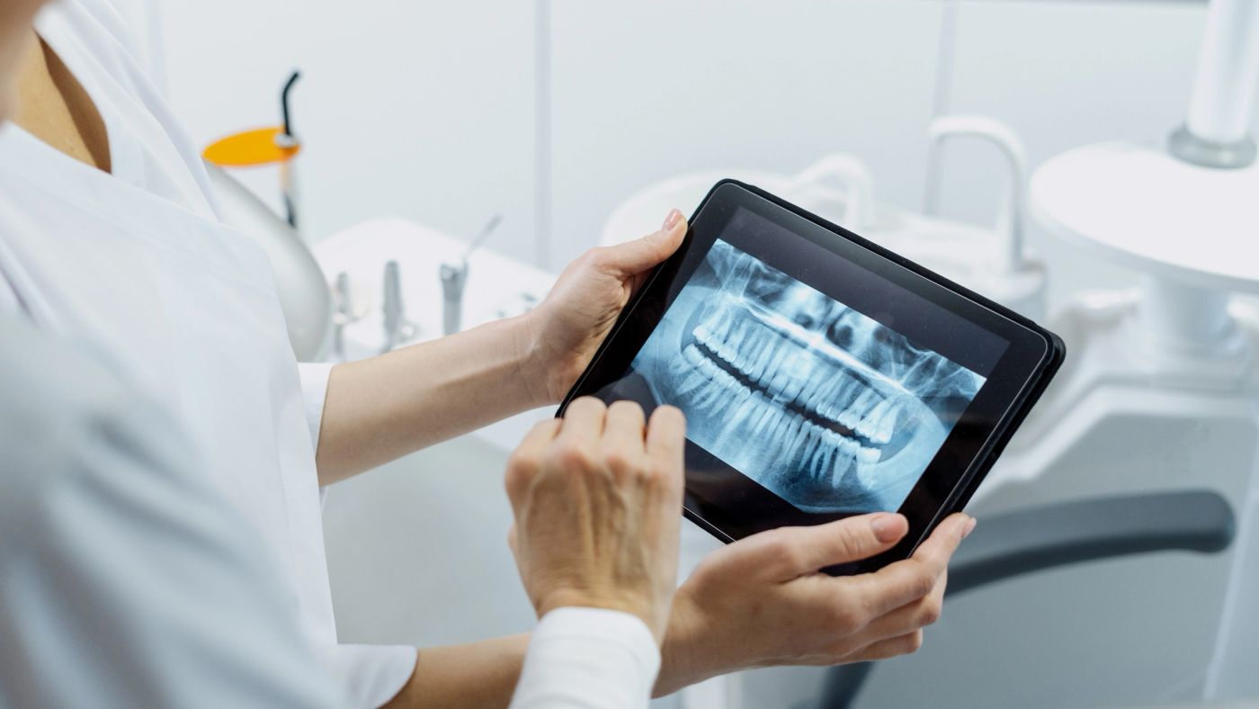 Oral Cancer Screenings in Tysons Corner, VA